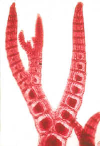 PolysiphoniaMicroTip240_small